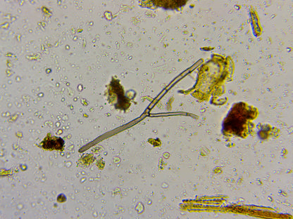 Microbiology Soil Assessment - Better Biology